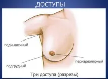 встановлення