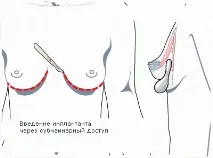 особливості