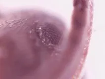 захищається