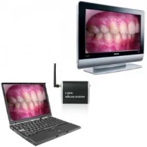 Wireless Dental Camera - бездротова зубна камера dental
