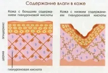 БАД №11 Гіалуронова кислота - Омолодження та здоров’я гіалуронова