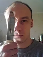 шкіру