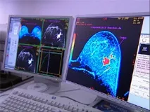 Цифрова мамографія що це переваги, способи підготовки переваги