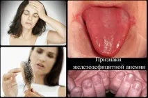 Нудота та запаморочення причини, у жінок, у чоловіків, блювання причини