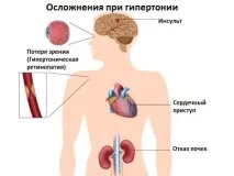 Нудота та запаморочення причини, у жінок, у чоловіків, блювання нудота