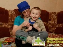 Фенілкетонурія фото - симптоми, діагностика, лікування, ознаки лікування
