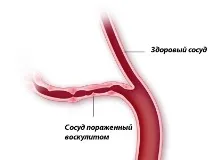 уражаються
