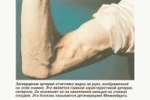 Гормон росту (препарат) в аптеці види, аналоги, побічні ефекти росту