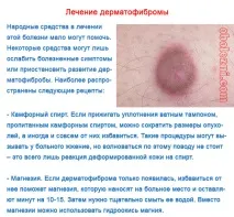 Дерматофіброма - фото та особливості захворювання захворювання
