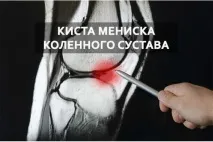 Як лікувати кісту тазостегнового, ліктьового, плечового та інших суглобів народними засобами кісту