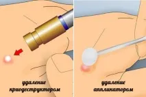 кріофарма
