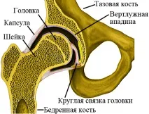 Лікування переломів шийки стегна у провідних клініках світу - Медицина Миру шийки