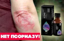 Нафталан Псорі PRO від псоріазу відгуки лікарів та покупців відгуки