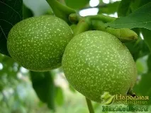 Полікістоз нирок ознаки, діагностика та всі способи лікування лікування