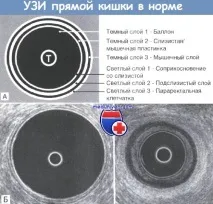 показання