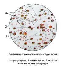дитини