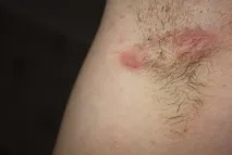 пахвою