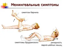 Ознаки та симптоми менінгіту у дітей наслідки, лікування, інкубаційний період менінгіту