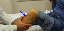 язки