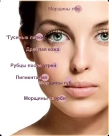 Ретиноєвий пілінгпризначення, особливості процедури ретиноєвий