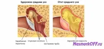 перфорація