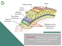 Зараження менінгітом – запалення мозкових оболонок запалення