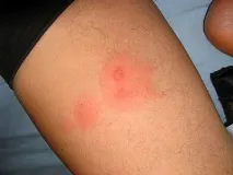 укуси