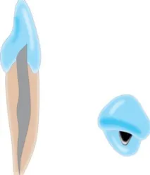 зубів