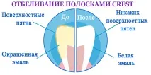 Що таке відбілюючі смужки для зубів і як вони працюють таке