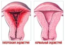 репродуктивної
