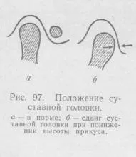 зубів