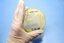 Як лікувати молочницю в домашніх умовах таблетки, свічки та народні засоби при молочниці лікувати