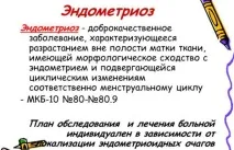 Як відбувається операція при ендометріозі матки матки