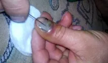 скалку