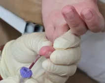 Лабораторні аналізи із позначкою «Cito! » лабораторні
