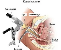 Лікування ерозії шийки матки - різні способи різні