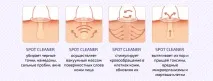 Spot Cleaner відгуки про прилад для вакуумного чищення обличчя вакуумного