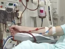 У Вінницькій області матеріали для гемодіалізу купили вдвічі дорожче області