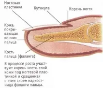 Врослий ніготь на великому пальці ноги ніготь