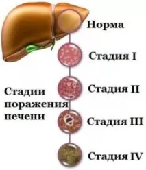 холетар