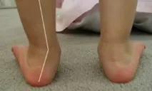 лшмд