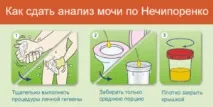 Аналіз сечі за Нечипоренком у дітей норма розшифровка результату норма