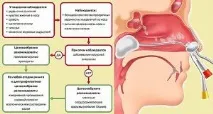 Алергічний риніт у дітей симптоми, причини та лікування алергічний