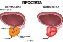 приемате