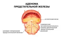 инструкции