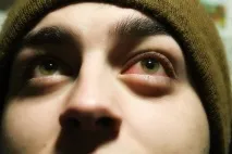 Болить ліве око болить