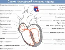 серця