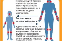 Гормональна мазь від дерматиту лікування