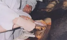 мошонки