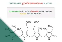 Концентрація уробіліногену в сечі – причини відхилень причини